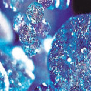 女子打玻尿酸鼻子感染险丧嗅觉 起诉医师获赔2万