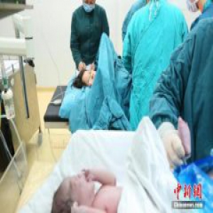 国家卫计委：近3年剖宫产率维持相对平稳态势