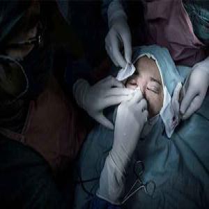 双语：中国女性整容花费超过全球平均2倍