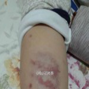 山东一小学教师被曝殴打学生 校方：临时聘用已辞退