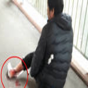 南亚裔劫匪在香港抢劫中国人 受害人脚筋被挑断