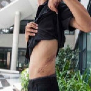 揭秘济南地下肾交易：患者花数十万 卖肾者仅得四万