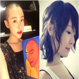 化疗剃光头戴假发 女星抗癌一年吐露心声