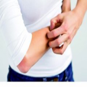 专家详解冬季护肤误区