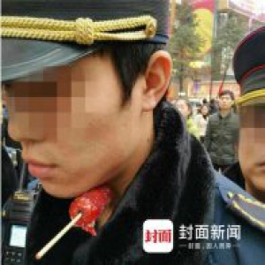 重庆城管执法遭女摊贩竹签刺喉 目击者：该商贩脾气暴