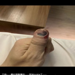 陈奕天的手因工作受伤惹粉丝担忧 还好陈奕天多才多艺