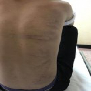 【长城评论】初中生都被锹把打断肋骨了，校园暴力还“不可避免”？