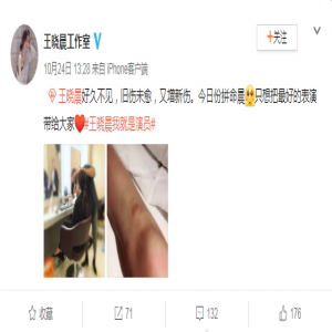 王晓晨为戏磕肿膝盖 网友：心疼！越努力越幸运