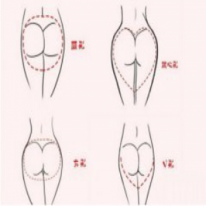 女性方形臀部都是坐出来的！学会三招能避免